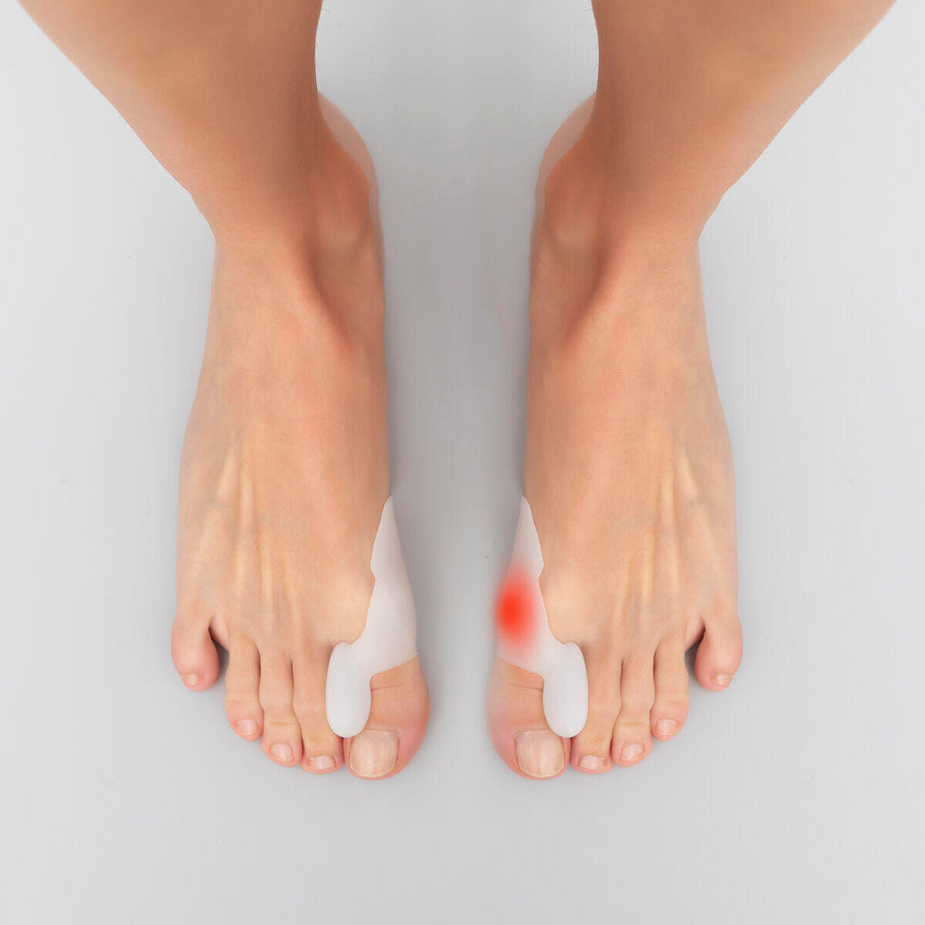 Corrector Protector de Silicona para Juanetes Bunilief 2 Unidades