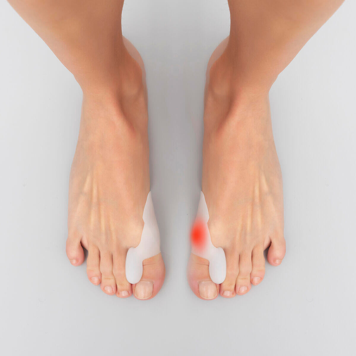 Corrector Protector de Silicona para Juanetes Bunilief 2 Unidades